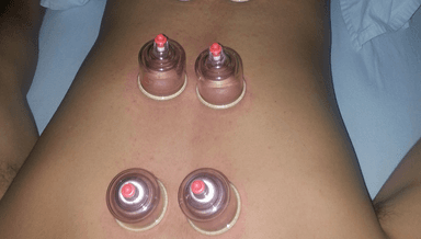 Image for Cupping Therapy (Silicone Cups ) ( Glass cups -to reduce more toxins)
